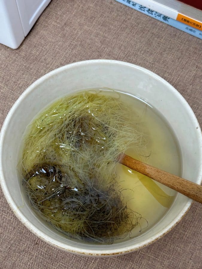 尿酸高、脚痛的进来，能帮一个是一个～